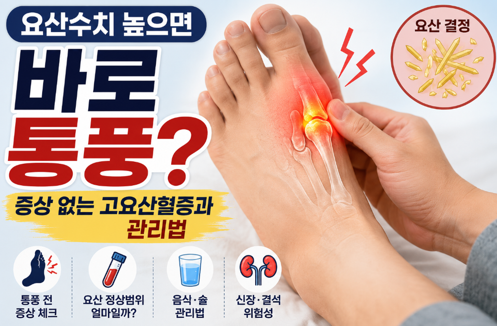 요산수치 높으면 생기는 증상과 낮추는 방법, 통풍 위험까지